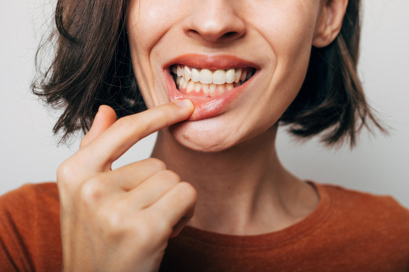 Patient smiling after orthodontic treatments