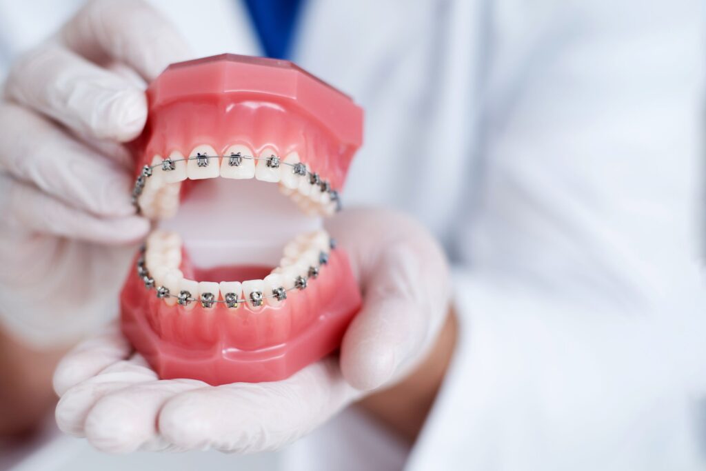 Dentist showing off model teeth with braces