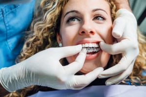 Close up of dentist fitting patient with Invisalign